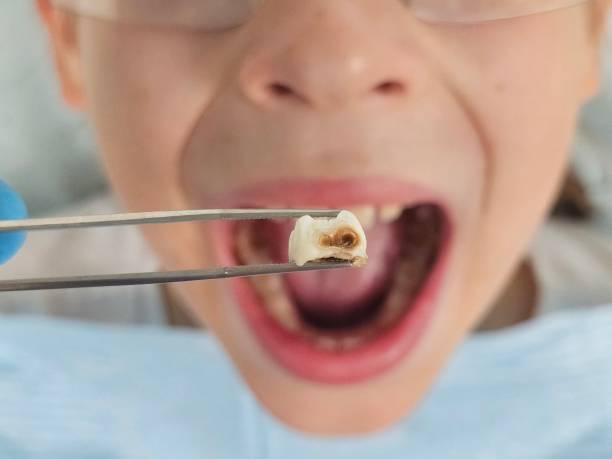 Best Emergency Care for Gum Disease in Upper Brookville, NY